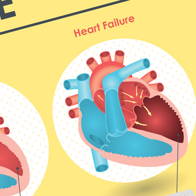 shf singapore heart foundation heart failure poster